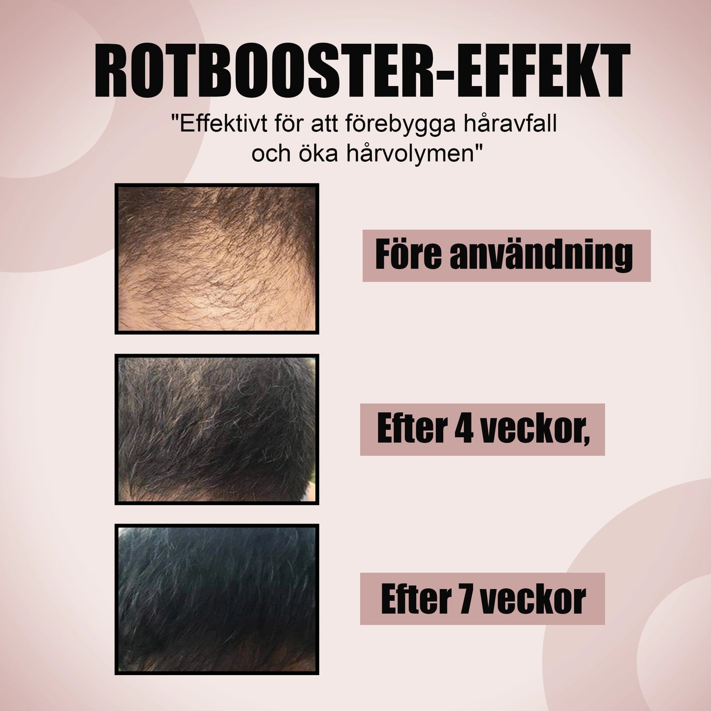 Hårbottenserum med Salicylsyra och Panthenol – 20 ml