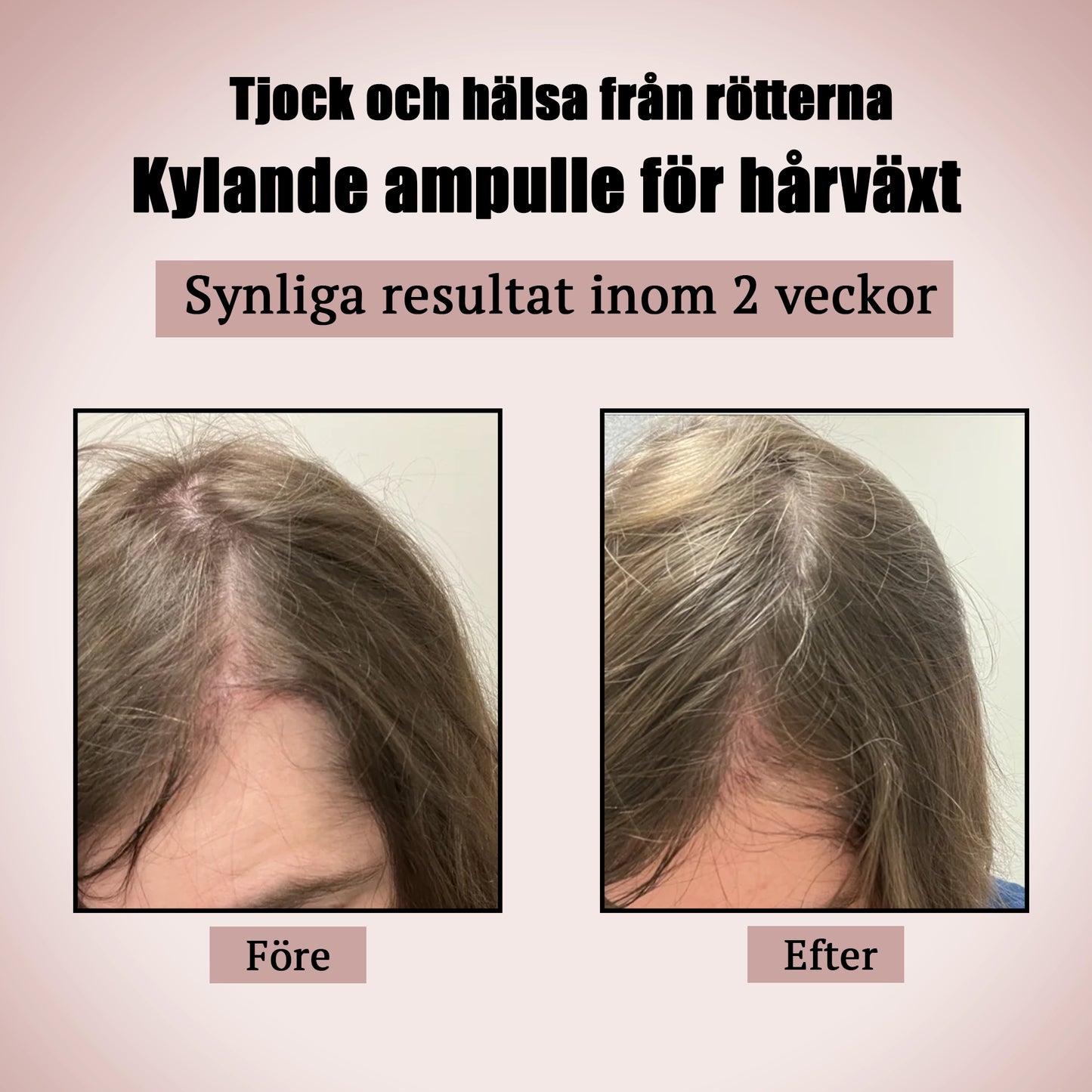 Hårbottenserum med Salicylsyra och Panthenol – 20 ml