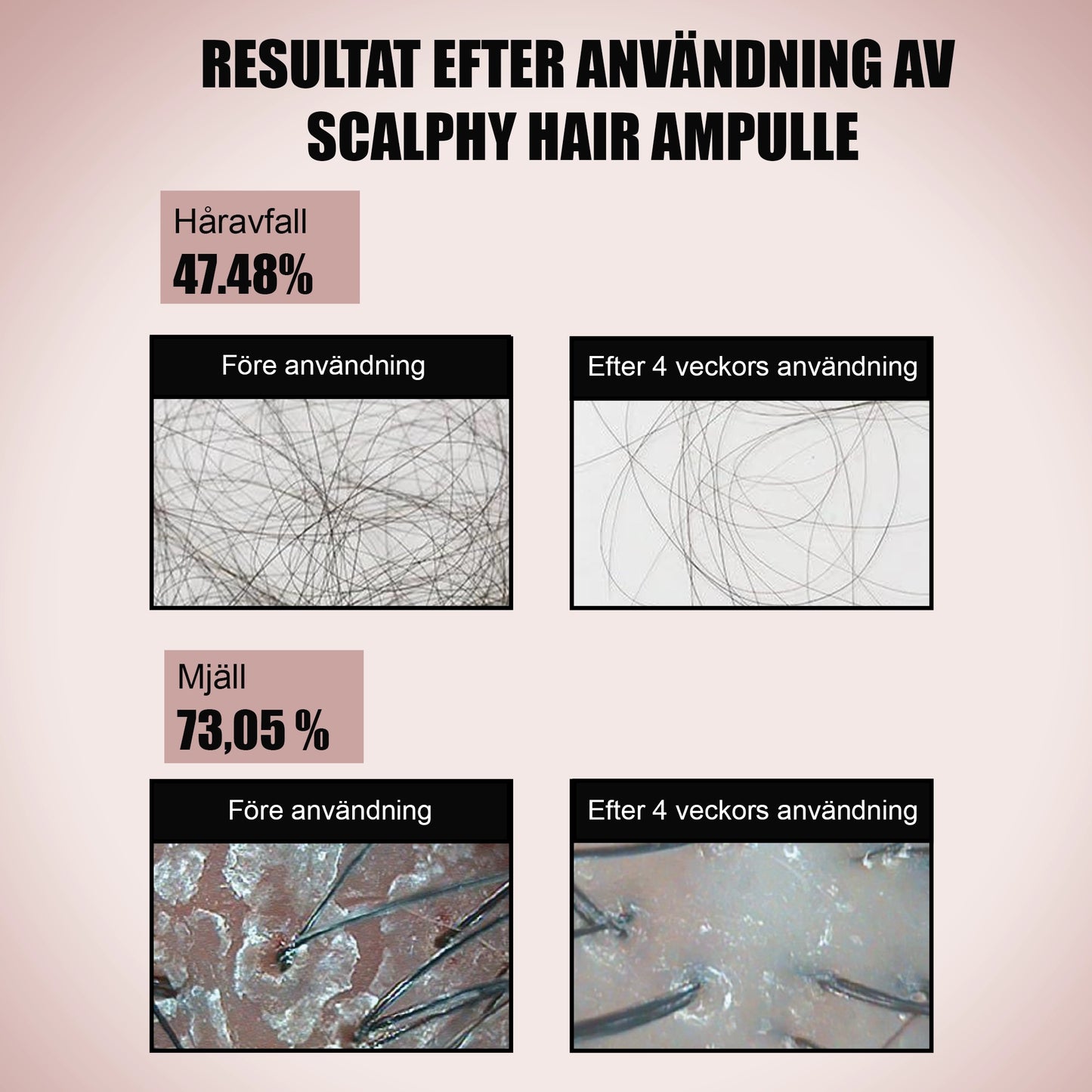 Hårbottenserum med Salicylsyra och Panthenol – 20 ml