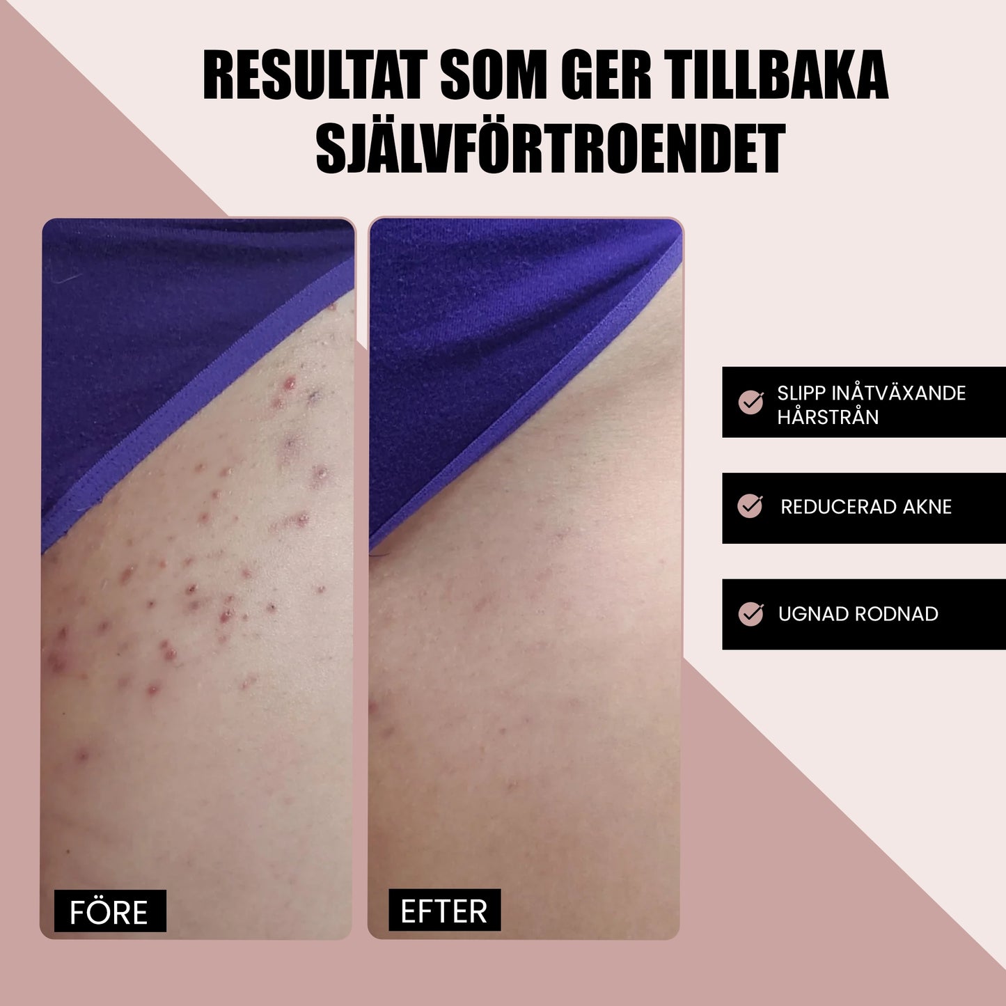 IPL Hair Removal Device for At-Home Light-Based Hair Reduction