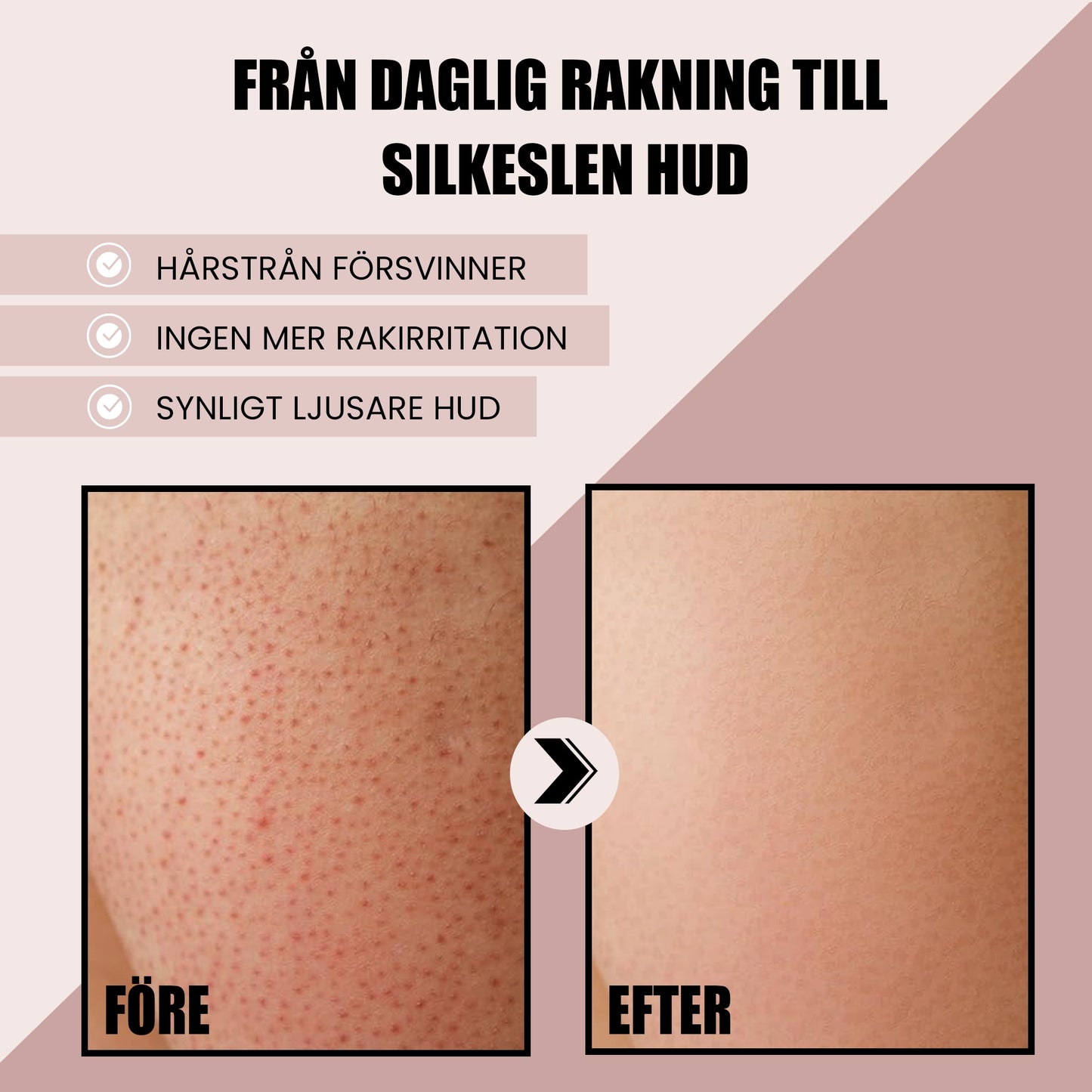 IPL Hair Removal Device for At-Home Light-Based Hair Reduction