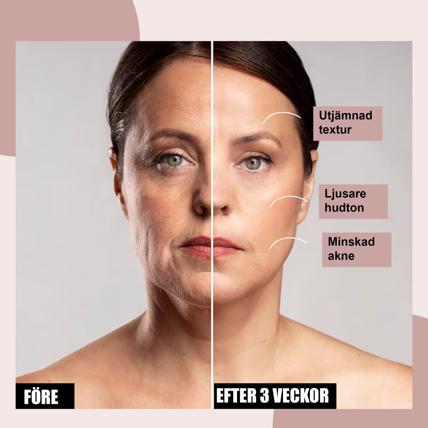 LED-Ljusterapimask för Ansikte med Flera Ljuslägen