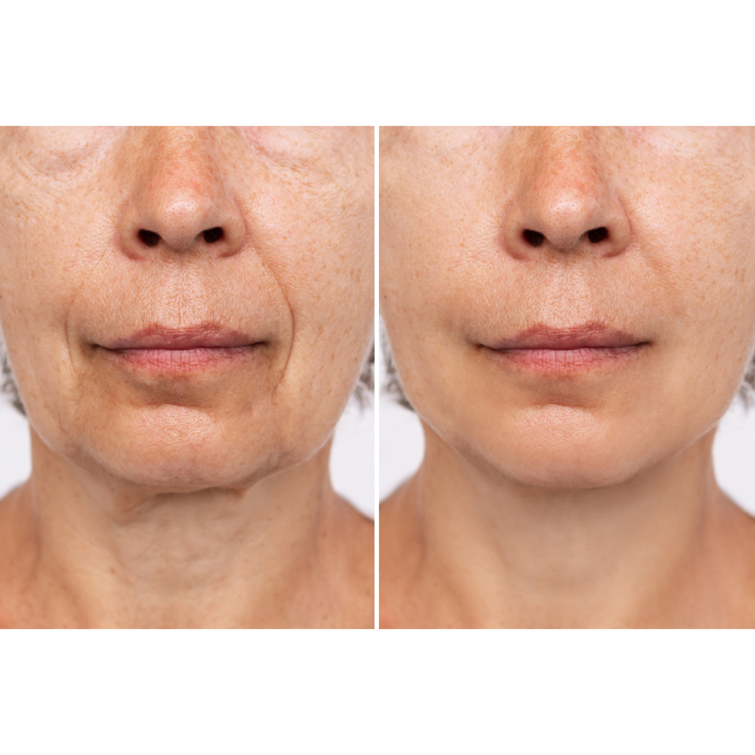 RadiancePulse™ | Electric Facial Massager