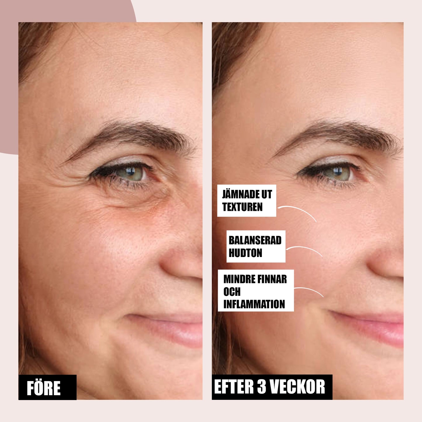 LED-Ljusterapimask för Ansikte med Flera Ljuslägen