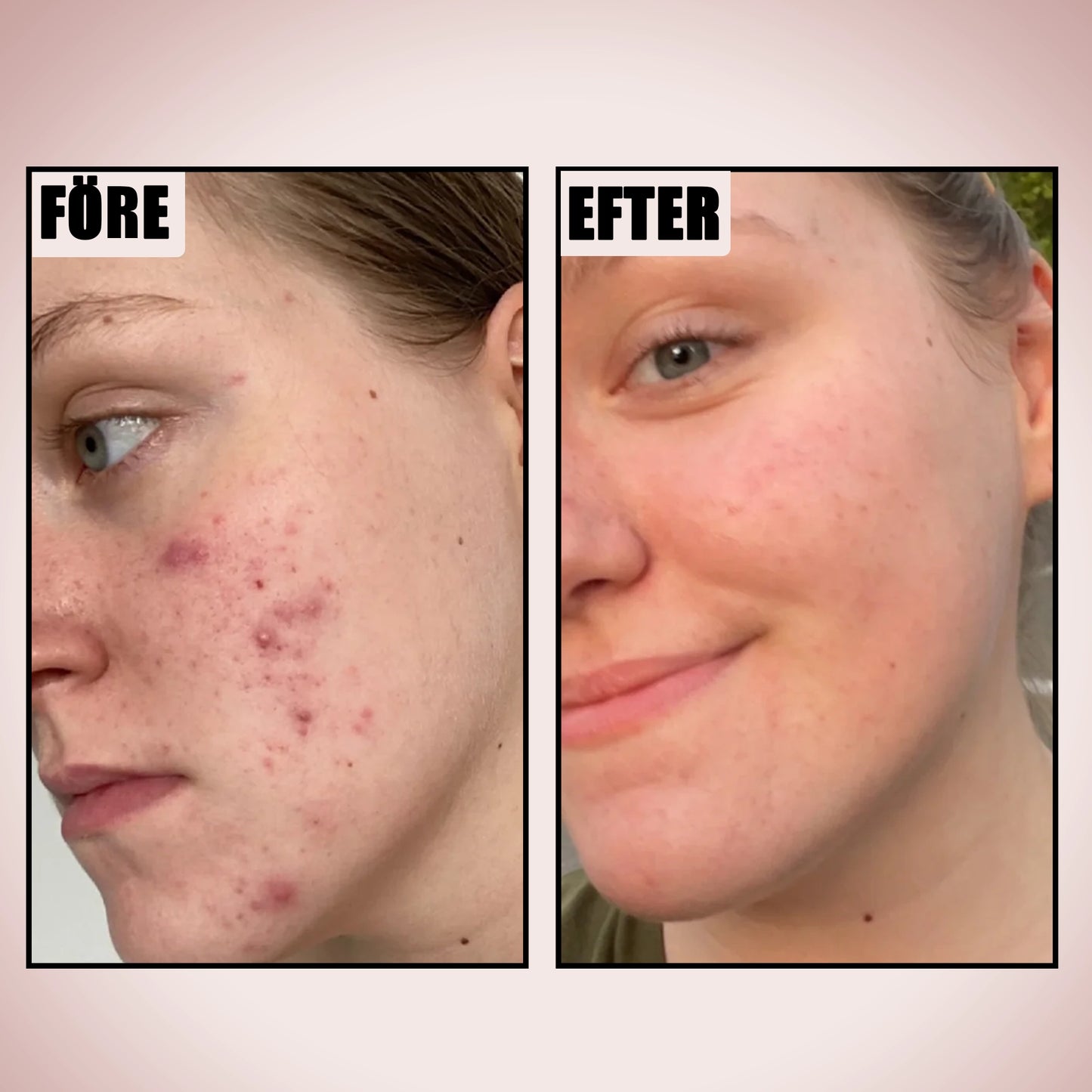 Kollagen Nattmask med Peel-Off-Formula för Ansiktet